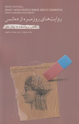 تصویر  روايت هاي روزمره از دمانس (نگاهي بي واسطه به زوال عقل)